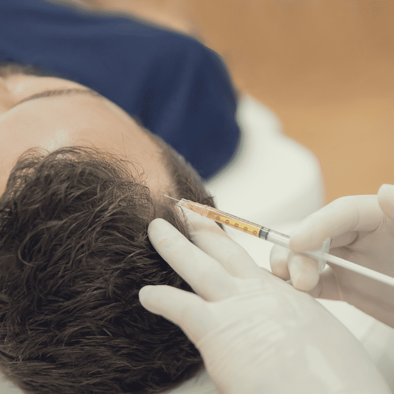 Hairloss treatments near me West Chester Cincinnati Hair Restoration Clinic Inertia Medical Medspa Scalp PRP Nutrafol Minoxidil Finasteride